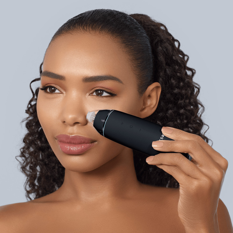 Мікродермабразійний пристрій для видалення чорних цяток GESKE MicroDermabrasion Blackhead Remover 7в1 black